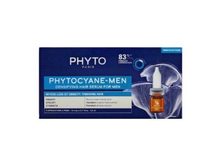 Anti-Hair Loss Treatment For Men Online Hot Sale